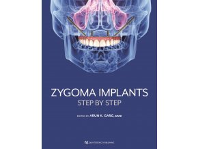 20921 cover garg zygoma implants