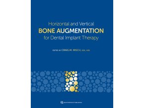 Horizontal and Vertical Bone Augmentation for Dental Implant Therapy