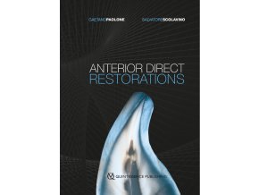 Anterior Direct Restorations