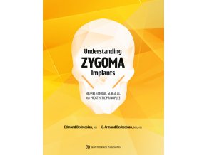 Understanding Zygoma Implants