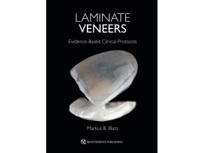 Laminate Veneers