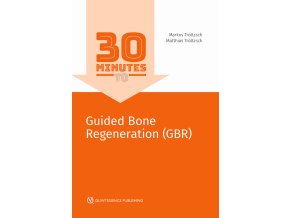Guided Bone Regeneration