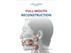 Full-Mouth Reconstruction
