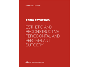 Perio Esthetics