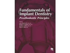 Fundamentals of Implant Dentistry