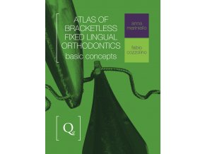 Atlas of Bracketless Fixed Lingual Orthodontics