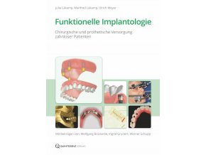 Funktionelle Implantologie