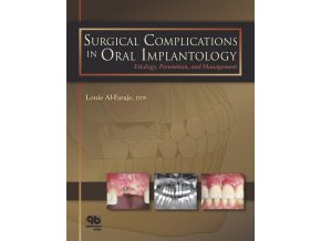 Surgical Complications in Oral Implantology