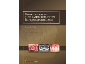 Komplikationen in der zahnärztlichen Implantatchirurgie