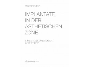 Implantate in der ästhetischen Zone