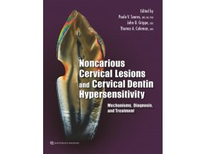 20961 Cover Soares Noncarious Cervical Lesions