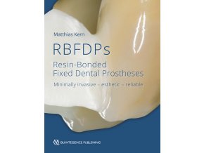 20611 Cover Kern RBFDPs Resin Bonded Fixed Dental Prostheses