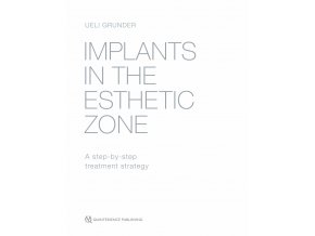 Implants in the Esthetic Zone