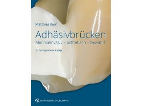 21680 Cover Kern Adhaesivbruecken NA