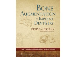 Cover 22081 Pikos Bone Augmentation in Implant Dentistry