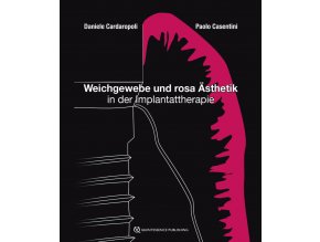 21880 Cover Cardaropoli Casentini Weichgewebe und rosa Asthetik in der Implantattherapie