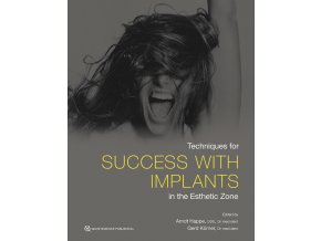 Techniques for Success with Implants in the Esthetic Zone