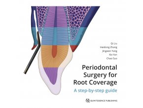 Periodontal Surgery for Root Coverage