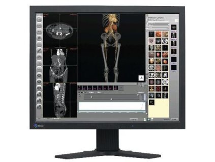 Eizo RadioForce R12, 19"