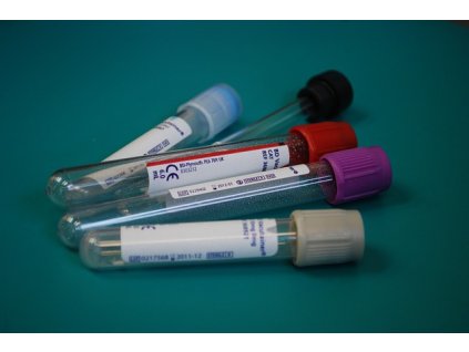 zdravi laboratory 313864 640