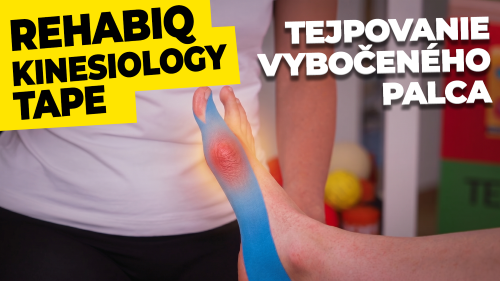 Ako zatejpovať vybočený palec (Hallux valgus)