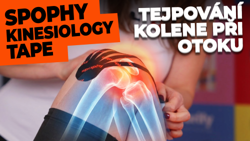 Tejpování kolene kineziologickým tejpem: úleva od bolesti a otoku
