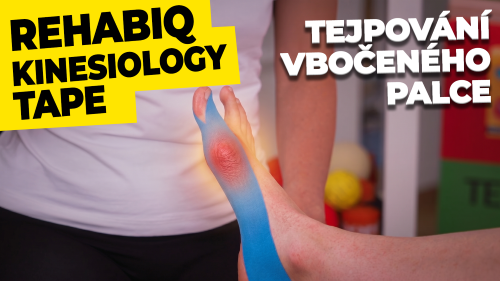 Jak zatejpovat vbočený palec (Hallux valgus)