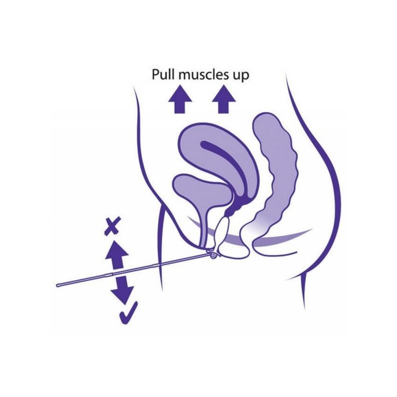 periform-vaginal-sonde