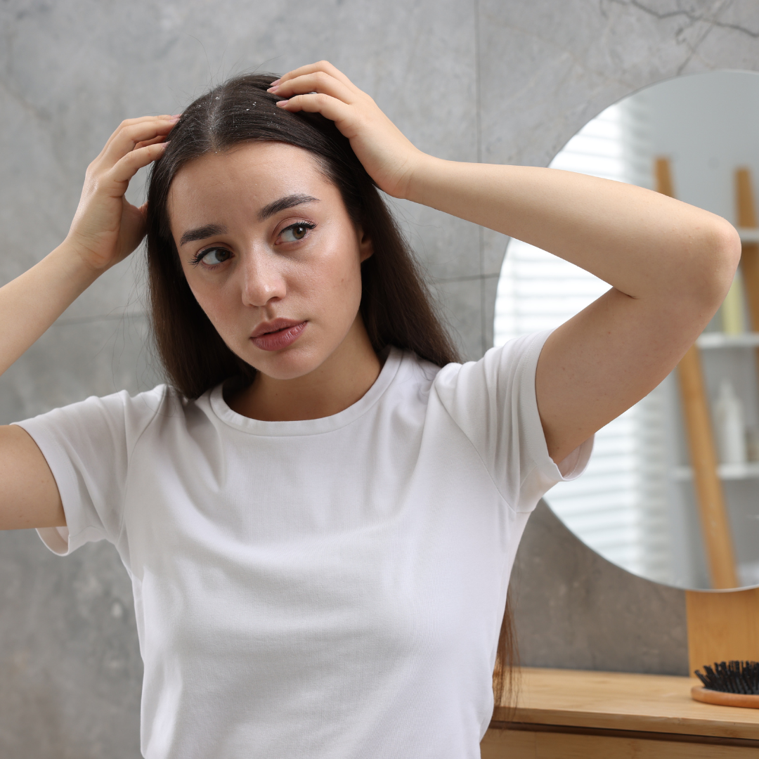 Jak se  zbavit lupů? Když pokožka hlavy volá o pomoc ...