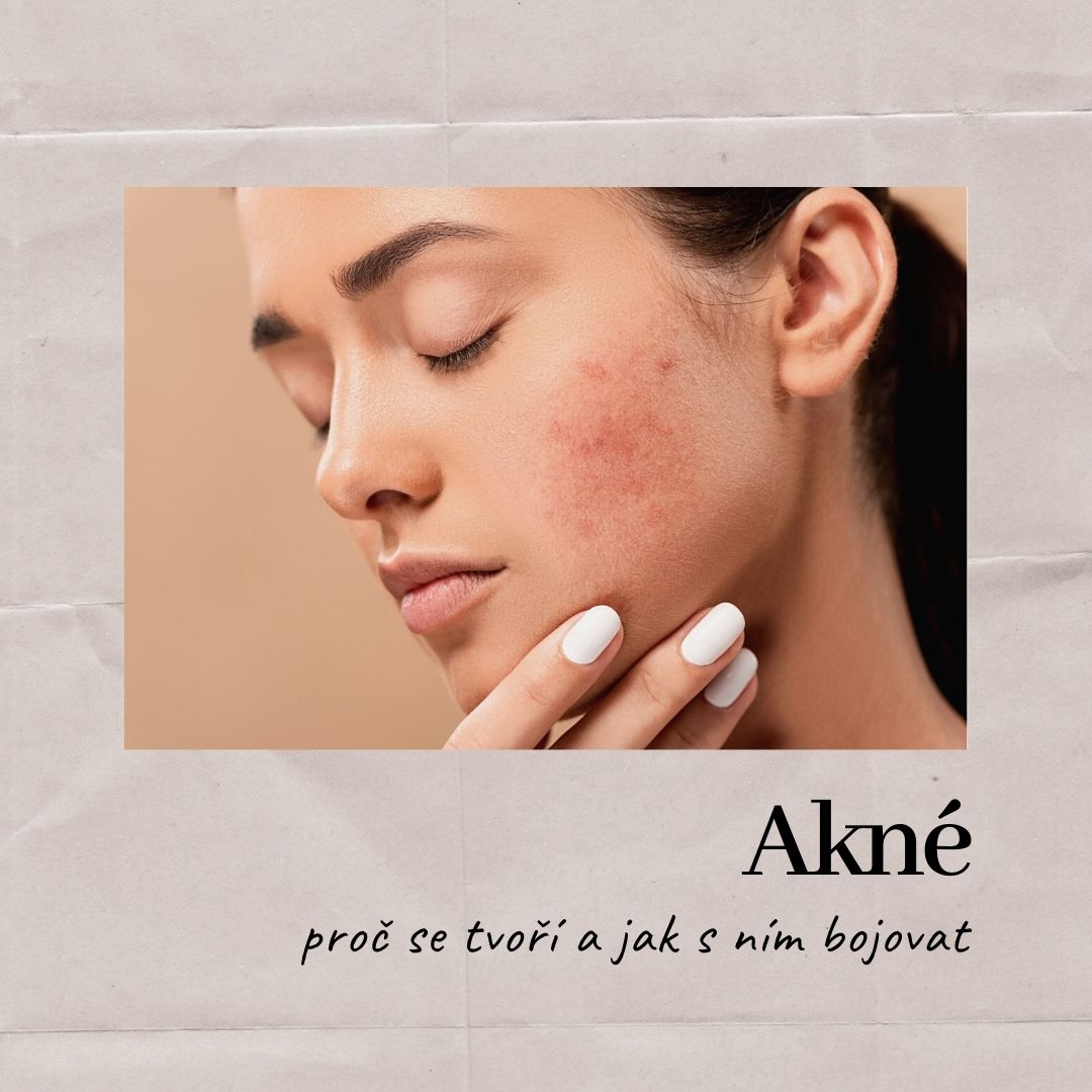 Téma akné
