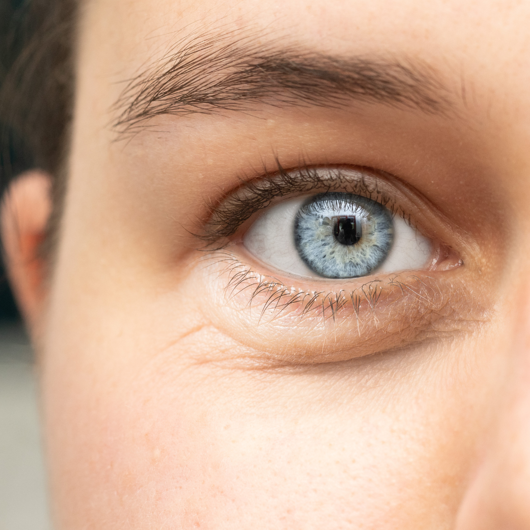 Pytle pod očima? Zatočte s unaveným pohledem a uberte si pár let