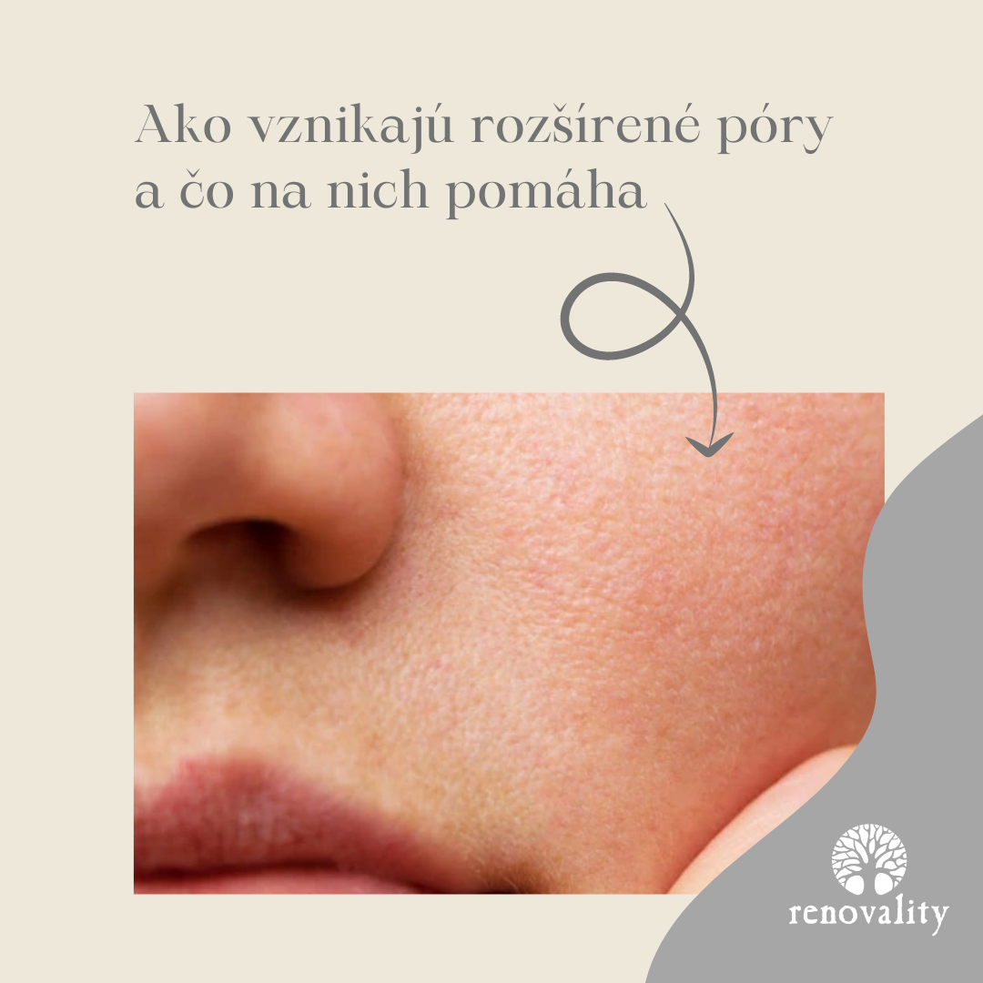 Póry naše každodenné....