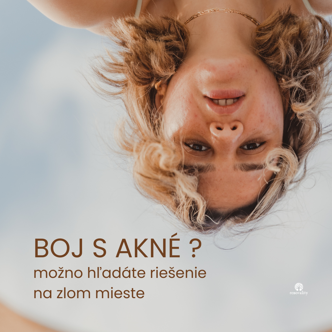 Akné a črevá: skryté prepojenie, o ktorom sa málo hovorí