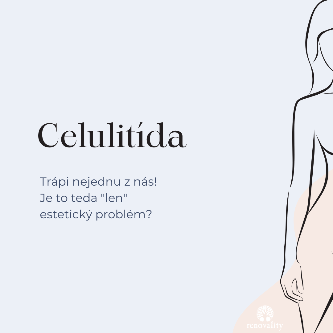 Celulitída