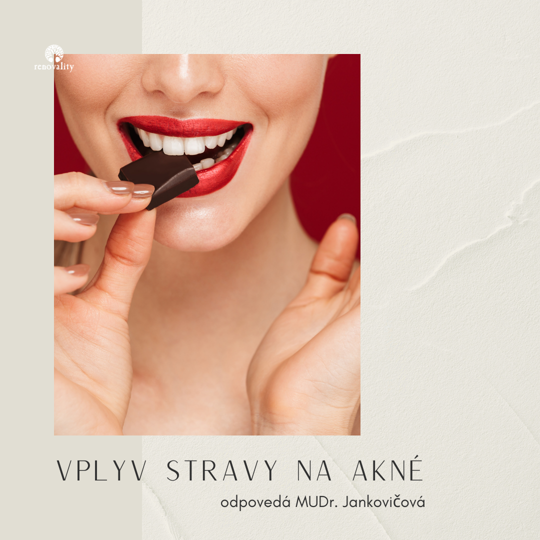 Ako vplýva na stav akné strava, zvýšený príjem cukru, diabetes, celiakia a užívanie probiotík