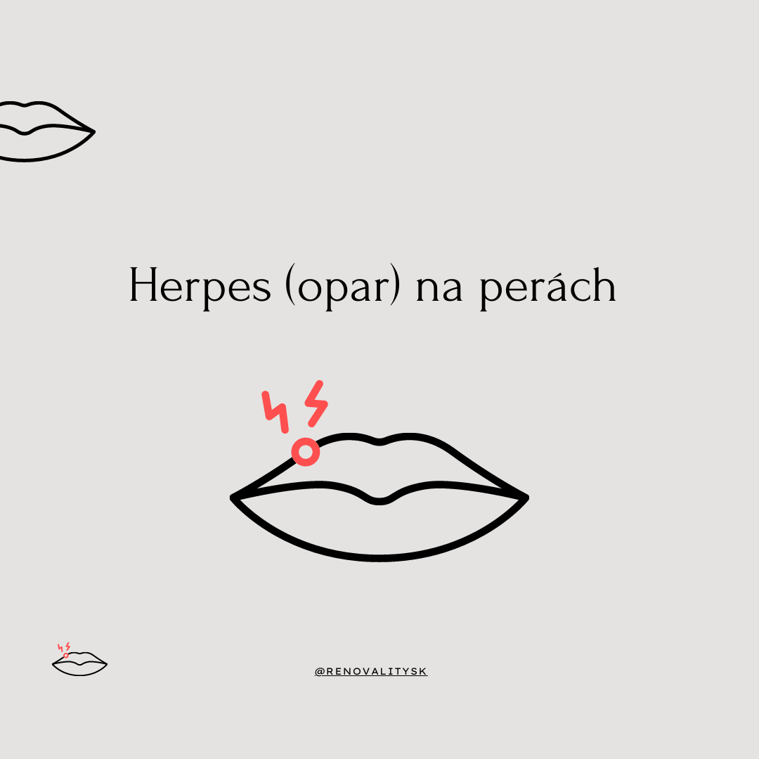 Ako vzniká, spúšťače, a ako opar (herpes) liečiť
