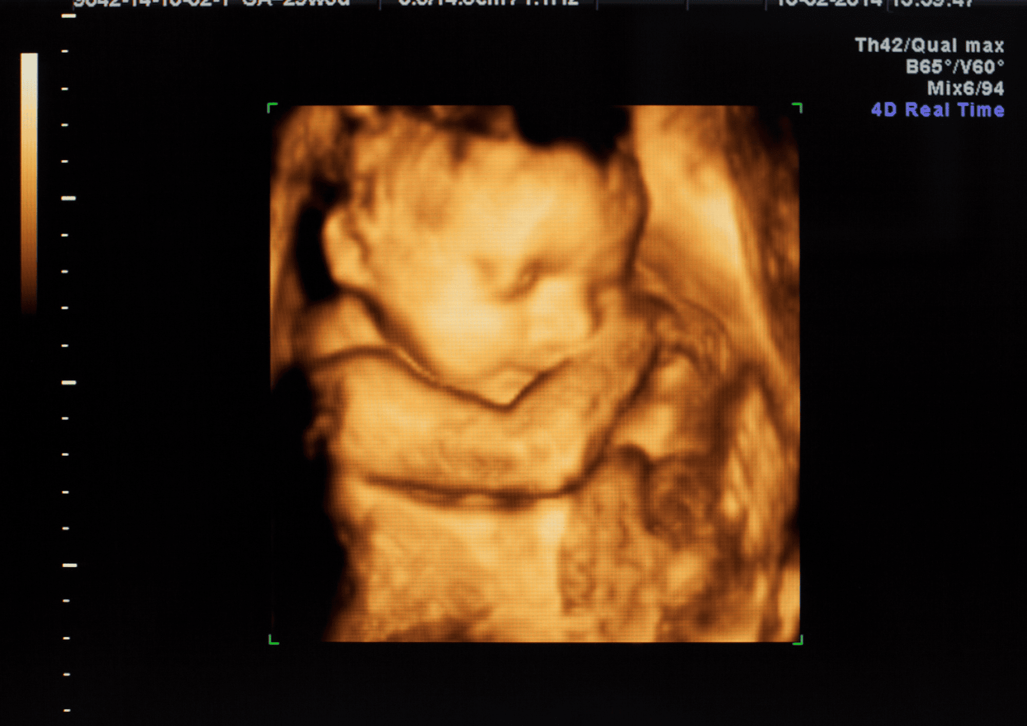 Kedy začne bábätko vnímať hlas a zvuky okolo seba?