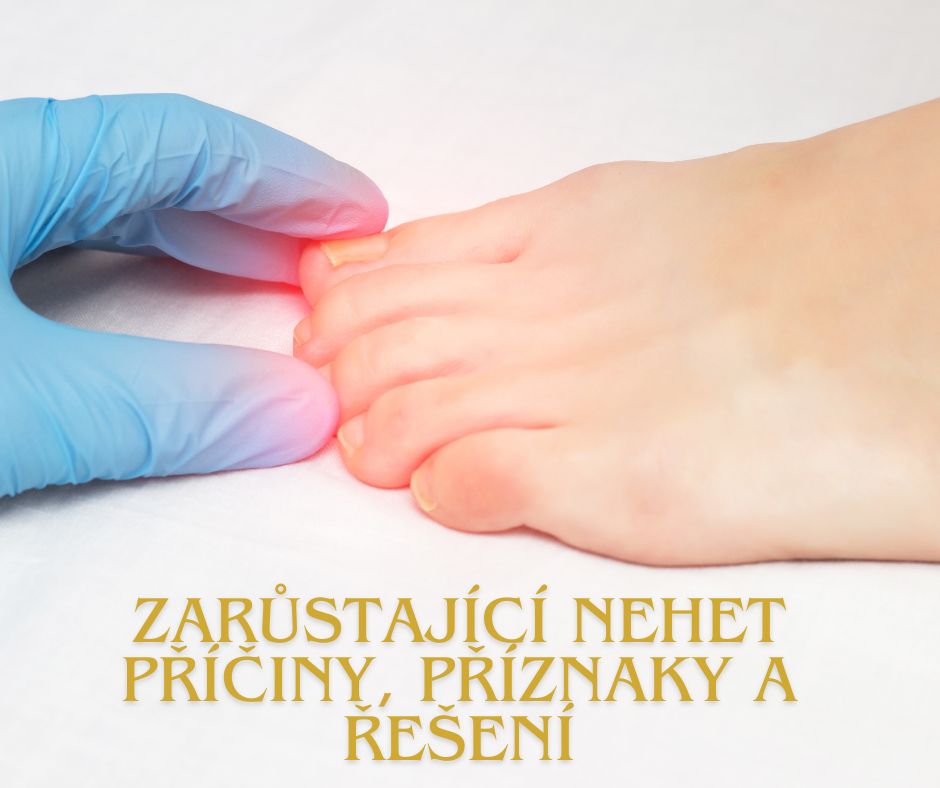 ZARŮSTAJÍCÍ NEHET – PŘÍČINY, PŘÍZNAKY A ŘEŠENÍ