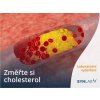 170 laboratorni test hladiny cholesterolu synlab (1)