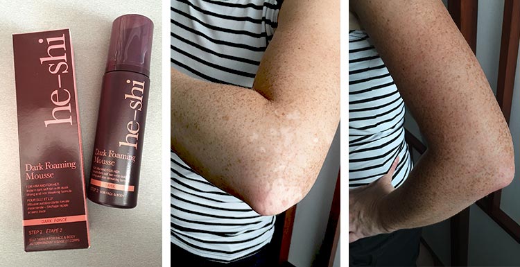 produkty-na-vitiligo