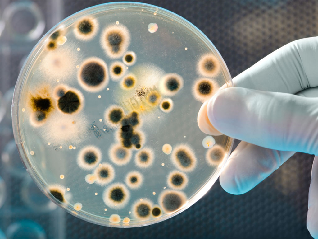 Najlepšie baktérie do septiku