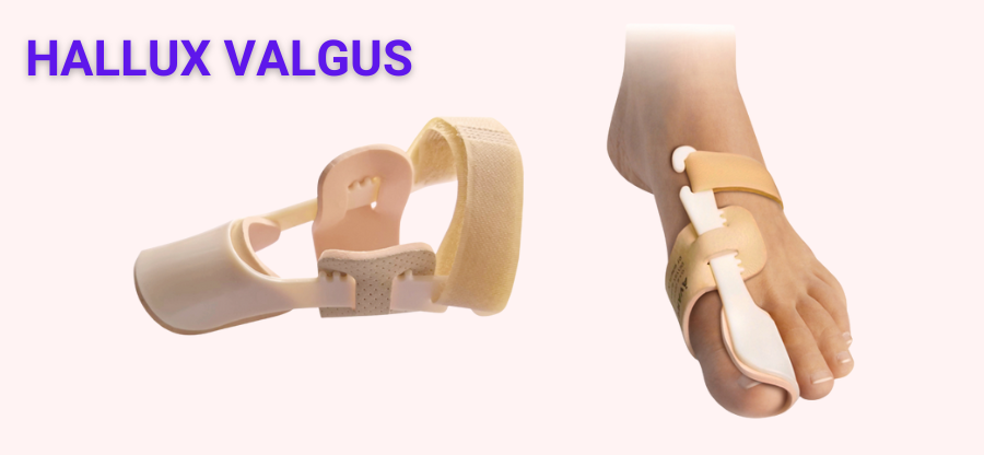 Hallux valgus - vbočený palec