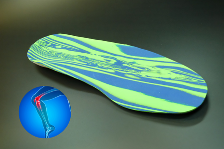 Vložky do topánok pri bolesti kolien a chrbta