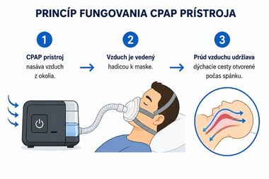 Princíp fungovania CPAP prístroja a udržiavanie otvorených dýchacích ciest