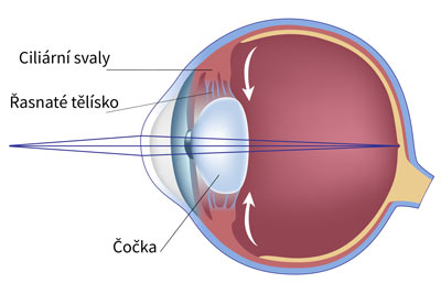 Akomodace aneb Ostrý pohled
