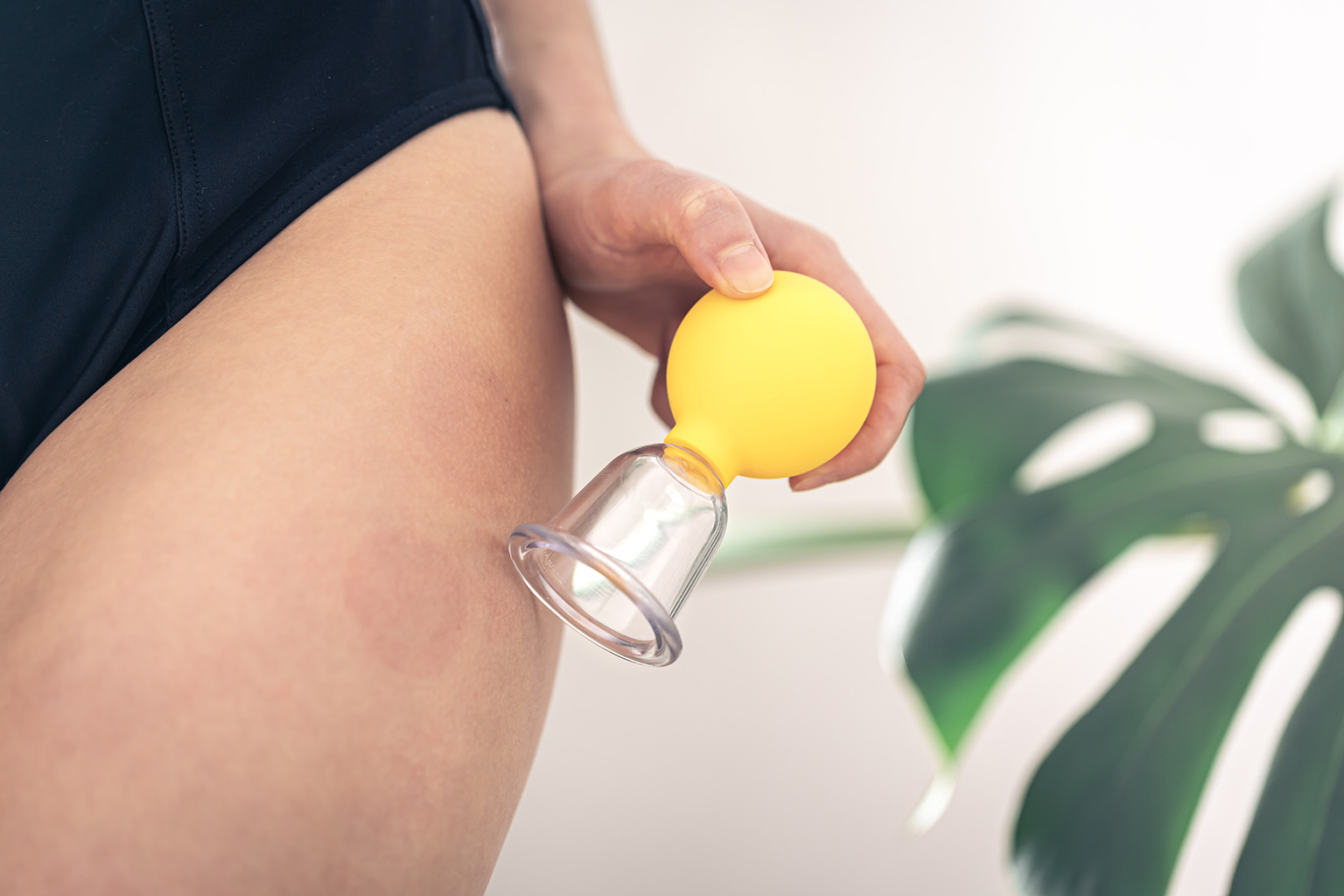 studiosarra_rollcupping_bankovani_masaz
