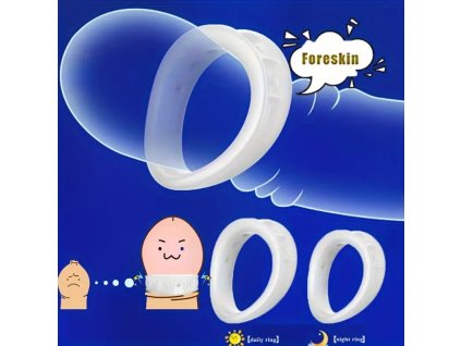 Prstenec na penis na obmedzenie predkožky 1