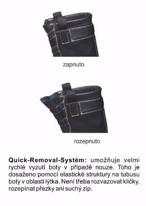 Quick-Removal-System