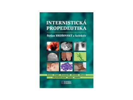 Internistická propedeutika