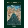 Výhodný balík kníh - Osteoporóza